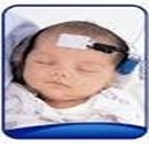Newborn hearing screening photo 2